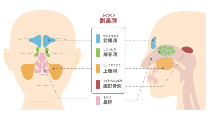 副鼻腔炎とは