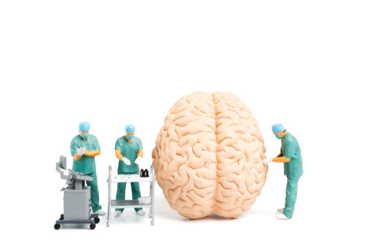 脳動脈瘤の治療の選択肢