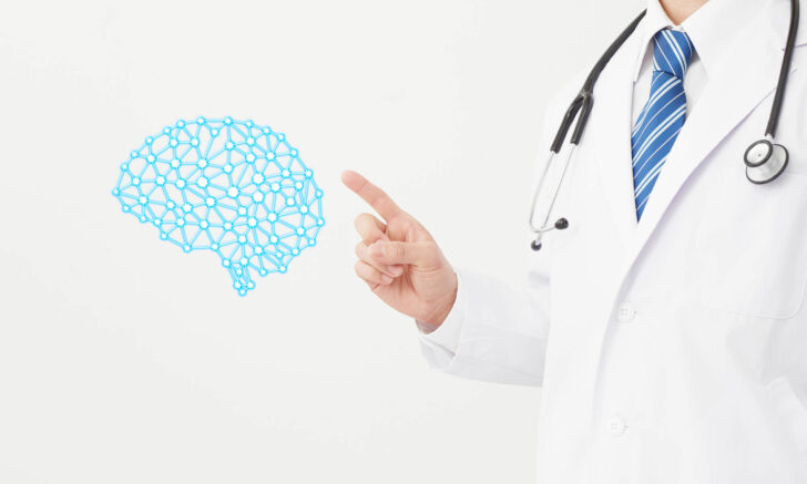 脳動脈瘤でフローダイバーターが適応となるケース