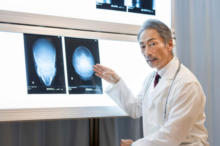 脳動脈瘤の原因