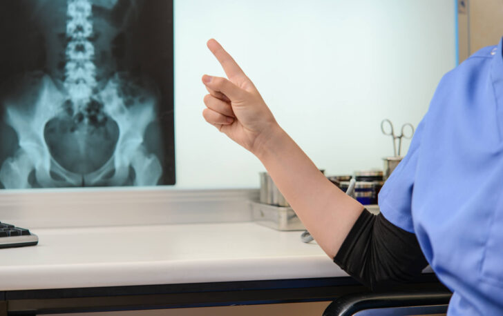 脊柱管狭窄症の検査