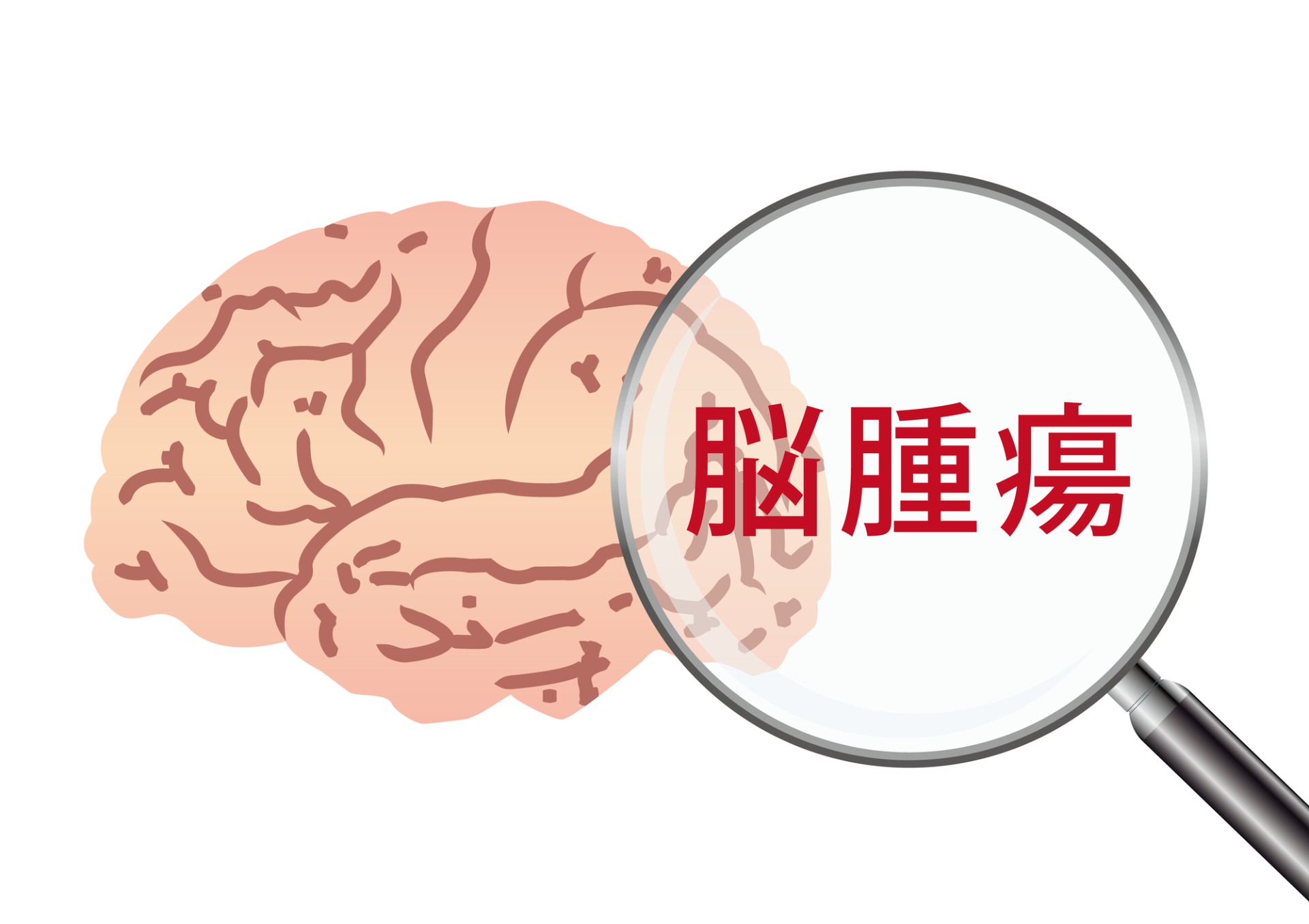 脳腫瘍の原因とは？症状やなりやすい人の特徴についても解説