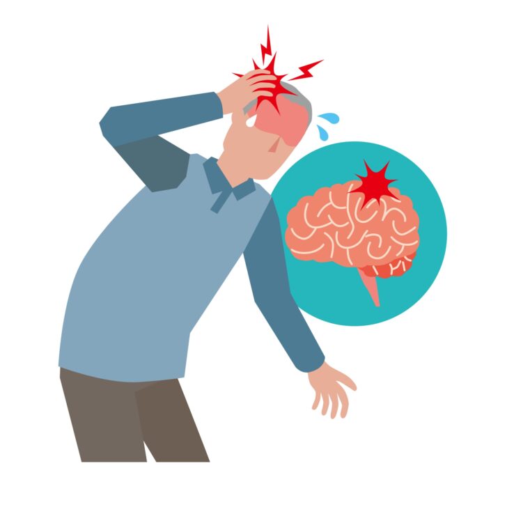 脳腫瘍になりやすい人の特徴