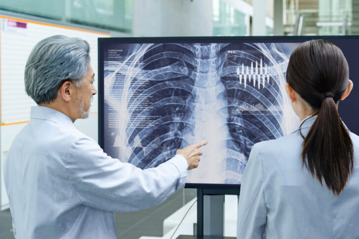 肺がんの放射線治療に期待できる効果