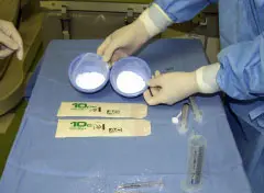 脊髄穿刺針から骨セメントのようなもの(アクリル樹脂とバリウム)を流し込み骨の強度を高めます。